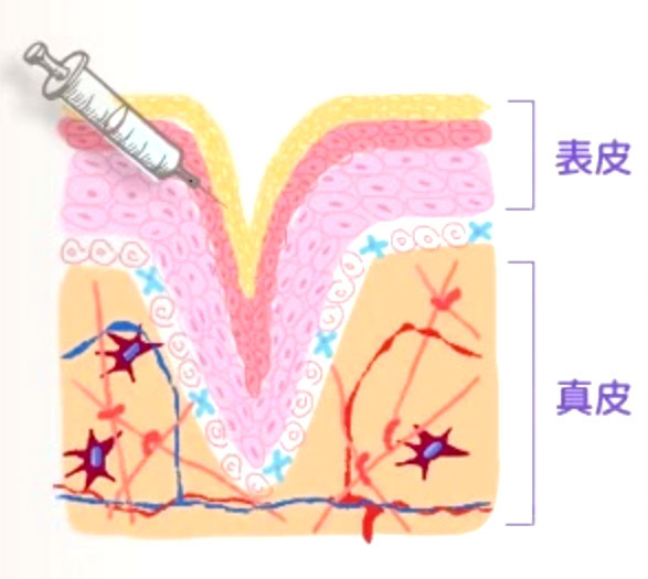 Derma Veil 童顏針 8