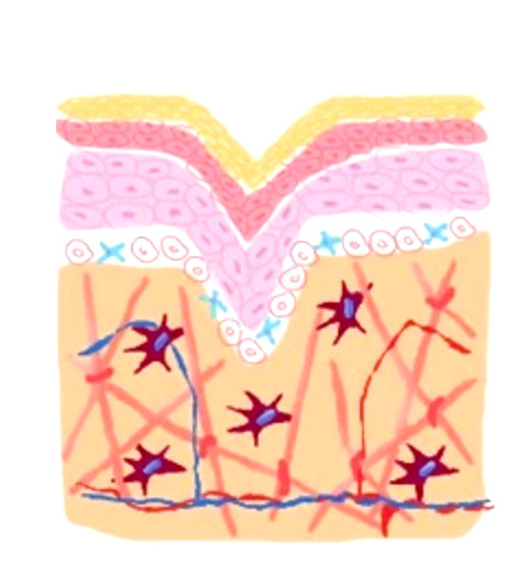 Derma Veil 9 - ​輪廓療程