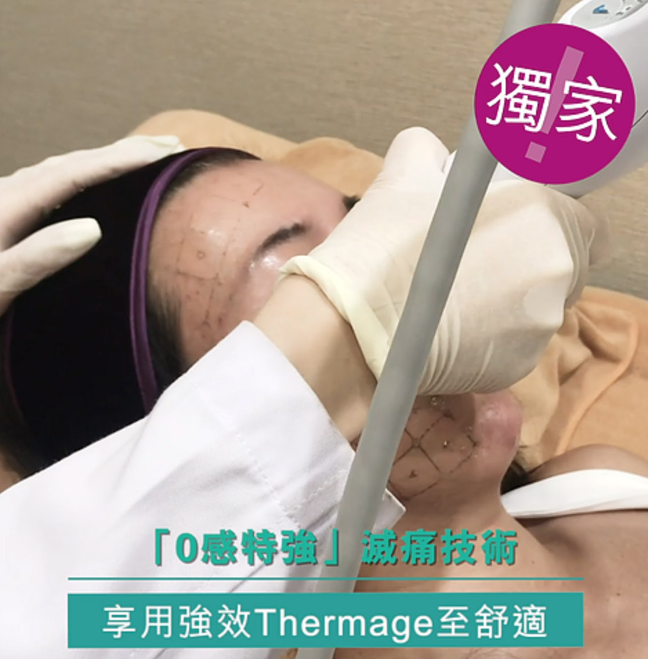 2-1 - Thermage第五代flx - 提拉療程