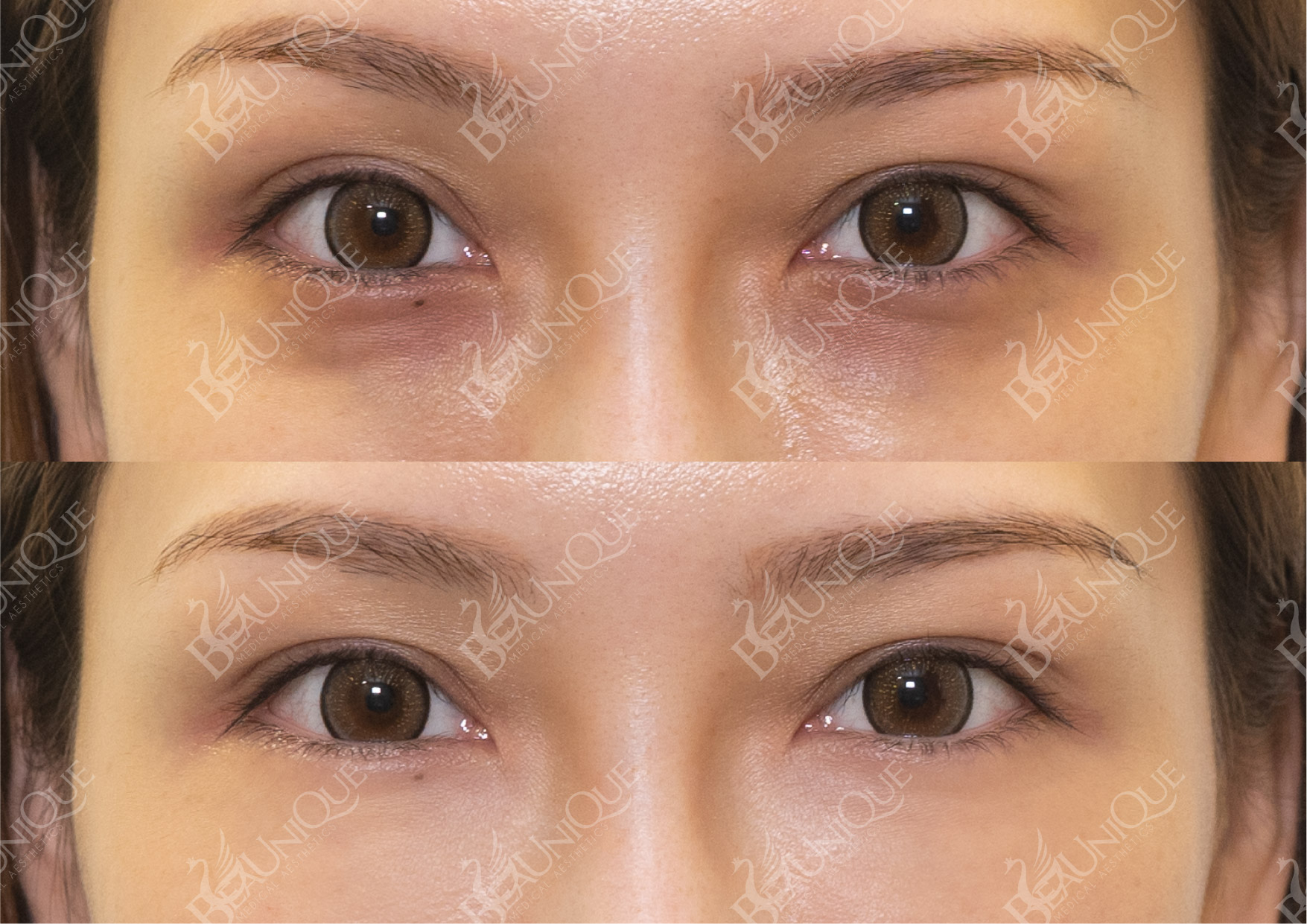 Before After Salekit 07