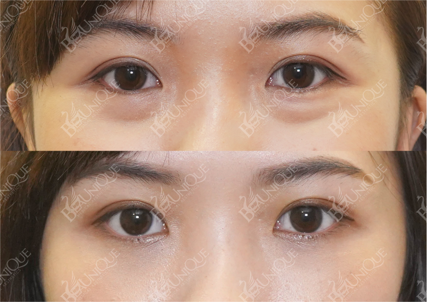 Before After Salekit 2 13