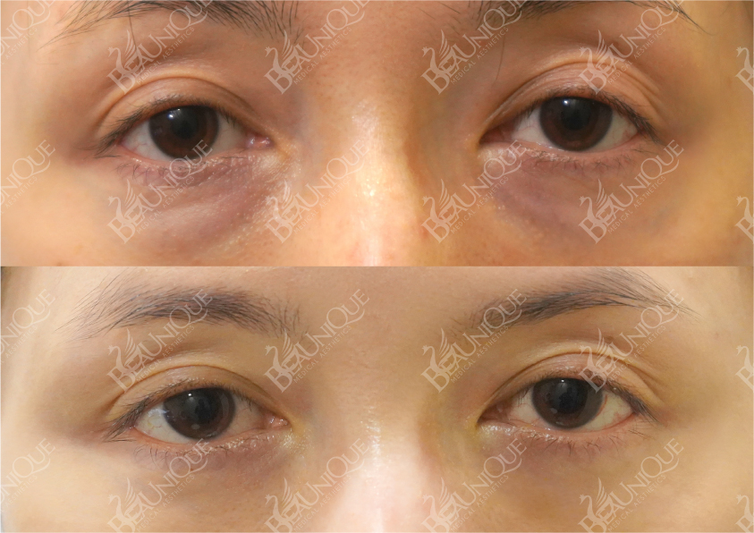 Before After Salekit 2 14