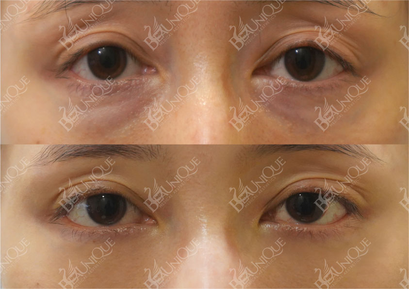 Before After Salekit 3 16