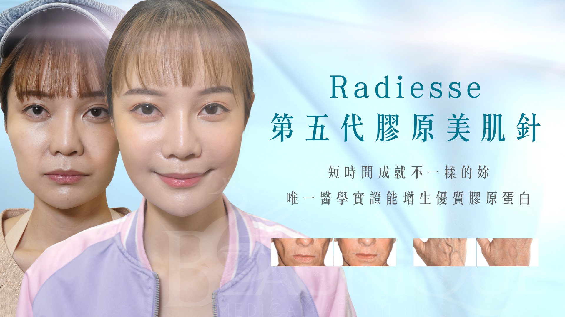 Radiesse 2 - Homepage