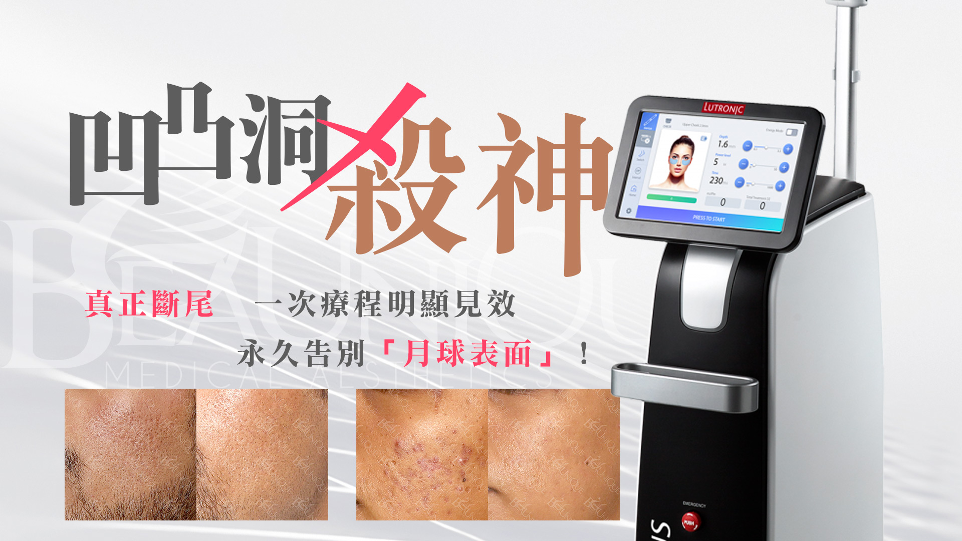2-1 - 凹凸洞殺神y5u4545y45y45y - 其他