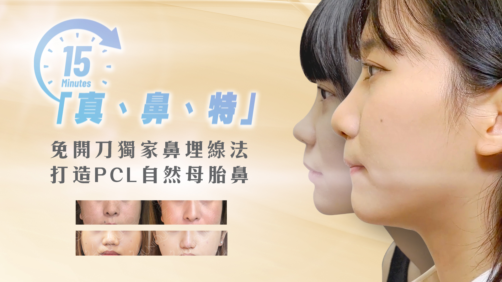 Nose 4