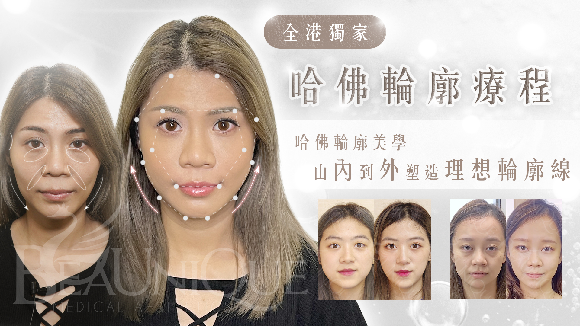 202321 - 哈佛輪廓療程 - ​輪廓療程