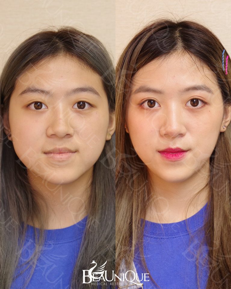 Beaunique Medical Aesthetics