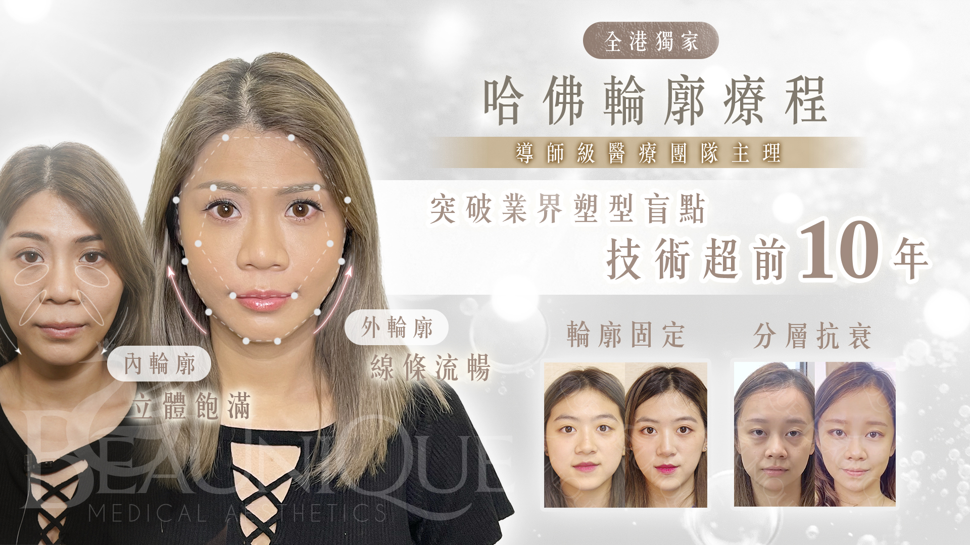 哈佛輪廓療程