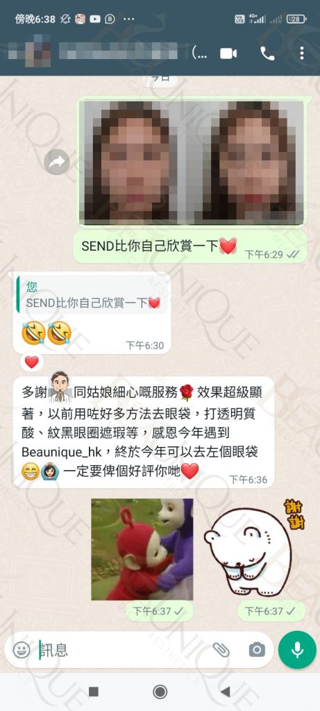A2398e53 33e4 4792 A208 B7349ceedf3b 1 461x1024 - 神仙棒去眼袋 - 眼部療程