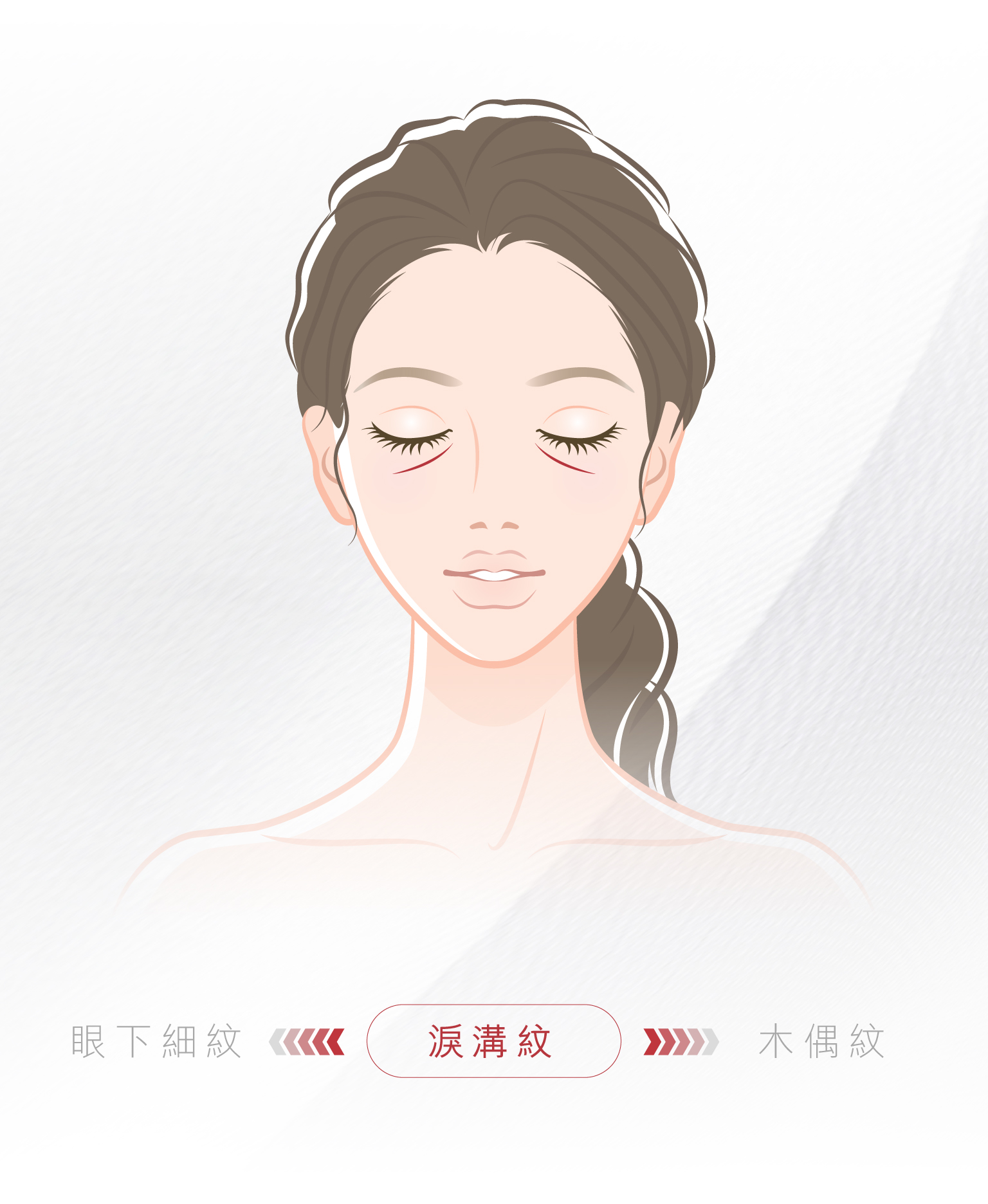 Asset 22 100