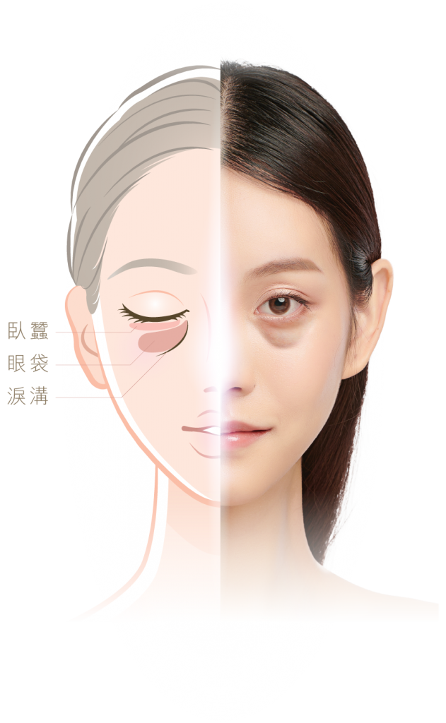 Md Face 631x1024 - 眼部療程