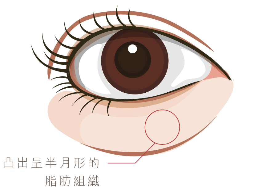 Md Graphic 2